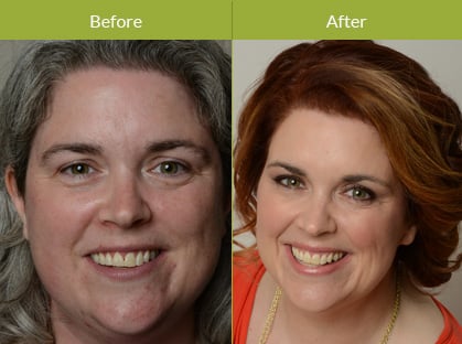Makeover Combination Makeover Combination