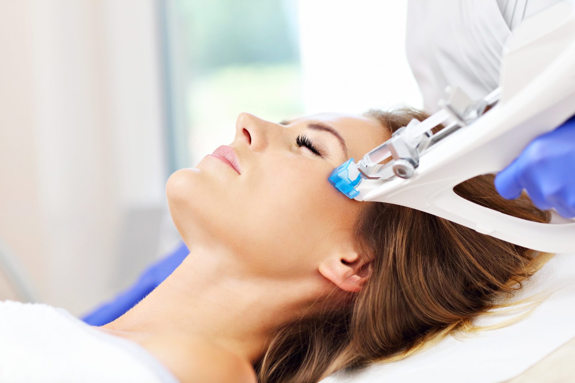 V2 Microneedling