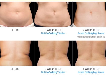 Results depicted in image may vary between patients and are not guaranteed 