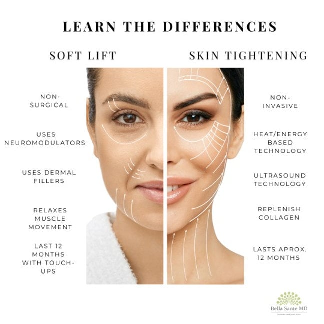 Skin Tightening vs. Soft Lift: A Guide to Youthful Skin at Bella Sante MD