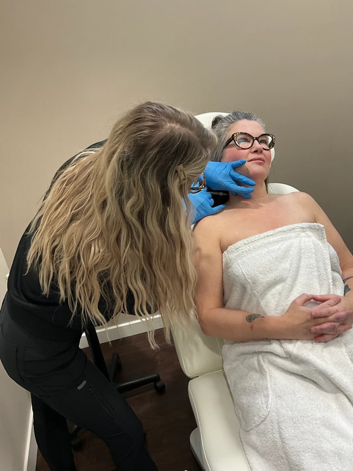 The Pros and Cons of Sculptra Treatment - Bella Sante