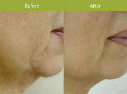 Before After Image Before After Image